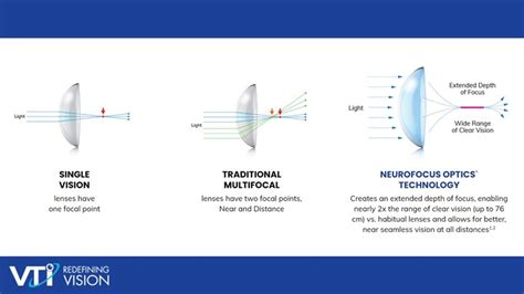 Understanding the NaturalVue multifocal contact lens | Myopia Profile