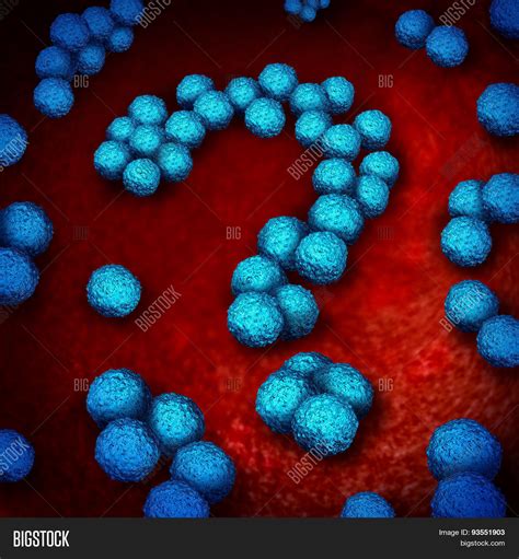 Superbug Infection Image & Photo (Free Trial) | Bigstock