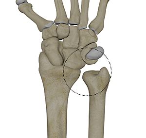 Distal Radioulnar Joint Anatomy