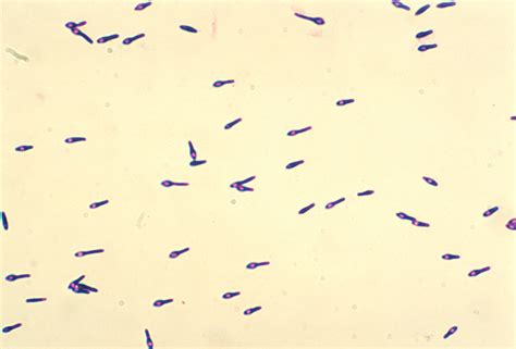 Public Domain Picture | A photomicrograph of Clostridium botulinum type ...