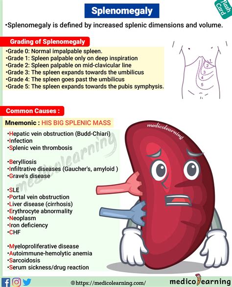 Splenomegaly – MedicoLearning