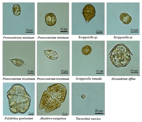 Morphology of algal strains used in this study under a light microscope... | Download Scientific ...