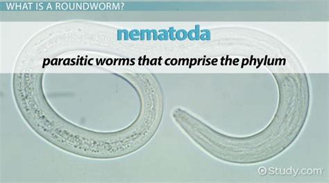 What are Roundworms? - Types, Examples & Characteristics - Lesson ...