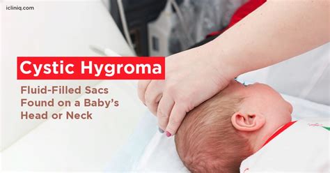 Cystic Hygroma - Fluid-Filled Sacs Found on a Baby’s Head or Neck