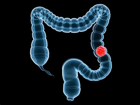 Proteogenomic Analysis of Human Colon Cancer Cell Lines