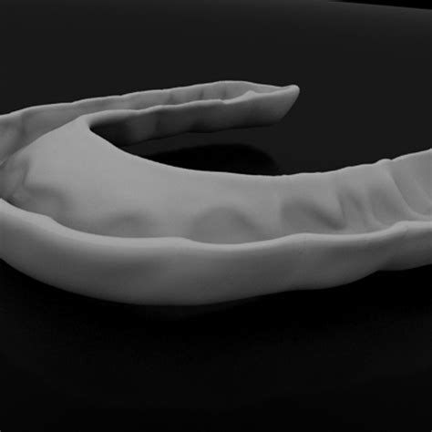 Bite Splint 3d Model