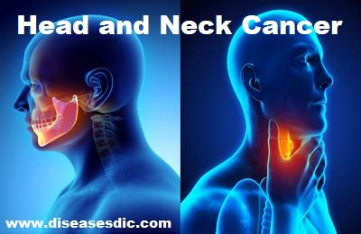 Head and Neck Cancer – Types, Risk Factors, and Prevention.