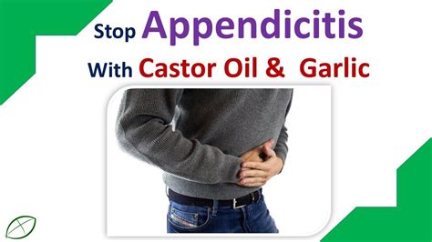 Home Remedies For Appendicitis | Stop Appendicitis With Castor Oil & Garlic - YouTube