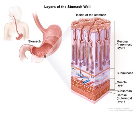 Gastric Cancer Treatment (PDQ®)–Patient Version - NCI