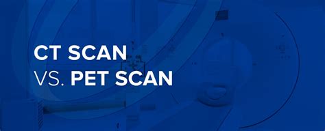 CT Scan vs. PET Scan - Health Images