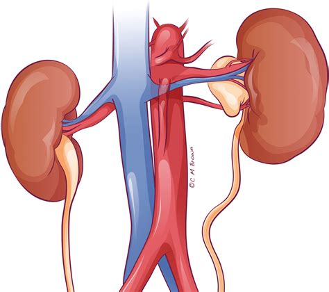 Multidetector CT of Vascular Compression Syndromes in the Abdomen and ...