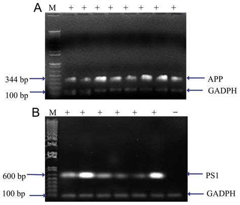 PCR-genotyping to identify APP/PS1 transgenic mice from DNA acquired ...