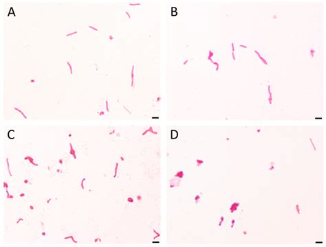 The light microscopy of H. pylori cells during the incubation with... | Download Scientific Diagram