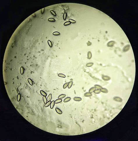 Pinworm Microscope