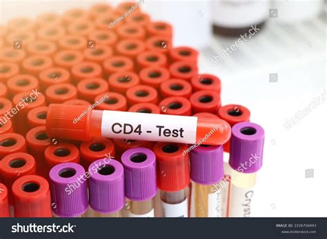 Cd4 Test Look Abnormalities Blood Blood Stock Photo 2226756943 | Shutterstock