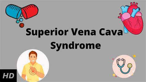 Superior Vena Cava syndrome, Causes, Signs and Symptoms, Diagnosis and Treatment. - YouTube