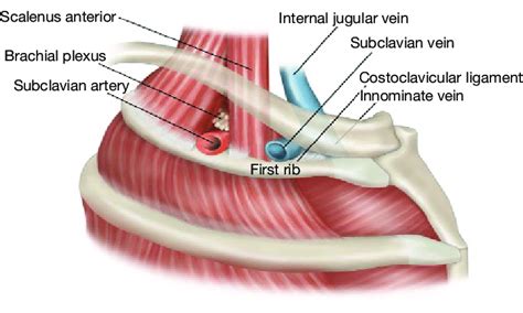 Normal thoracic outlet anatomy, with subclavius muscle removed ...