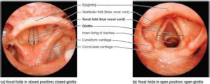 Epiglottis anatomy, location, function and epiglottis infection