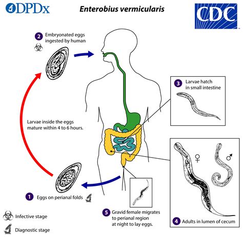 Enterobius vermicularis- Morphology, Life cycle, transmission ...