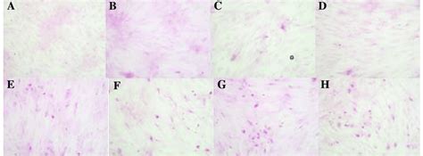 Alizarin red staining (magnification, x100). Undifferentiated MDSCs at ...