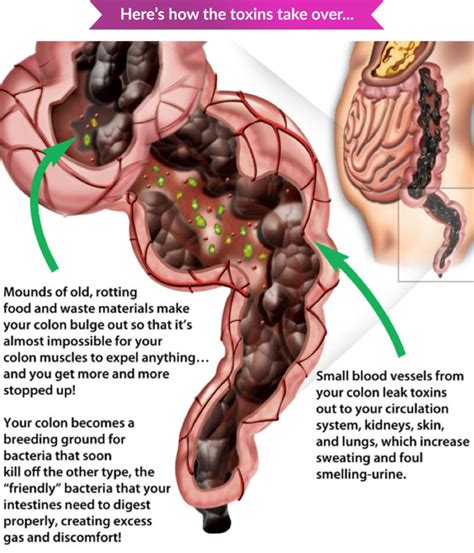 Constipation & Bowel Movement - Functional Health Network Functional Health Network