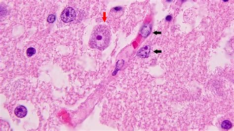 Acanthamoeba Histology