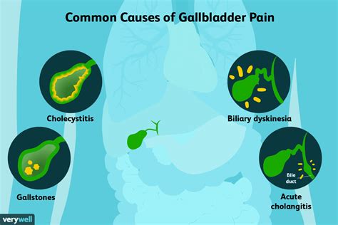 Gallbladder Stones Symptoms