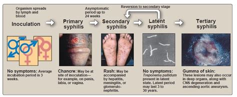 Pathogenesis and Clinical manifestations of Treponema pallidum