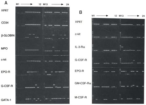 Gene expression in individual CD34*, lin^ cells. CD34^ lin^ cells were ...