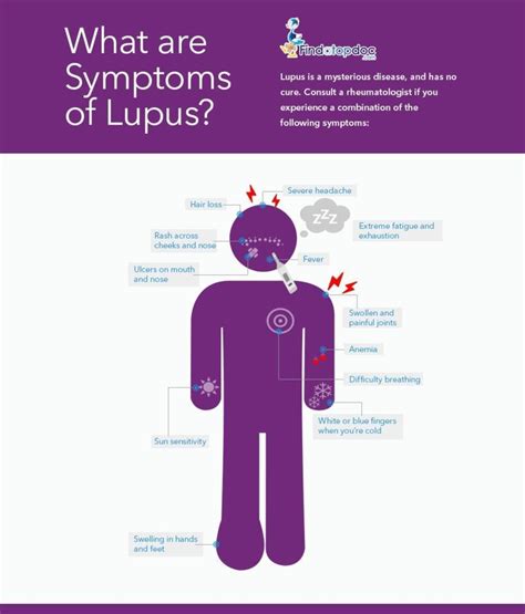 What are the symptoms of Lupus? [INFOGRAPHIC]