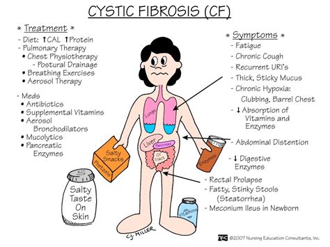 A guide to Cystic Fibrosis (CF) for first aiders | First Aid for Free