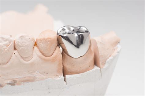 The Different Types of Dental Crowns, Explained - Newbury Dental Group