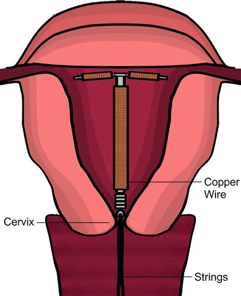 Reproductive Health Population Explosion and Birth control measures - Study Material for NEET ...