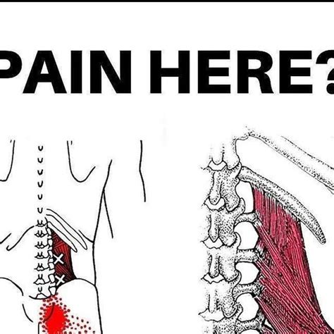 Neck Pain | Back Pain on Instagram: "💥QL Pain💥 ⁉️ Do you have pain in ...