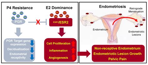 IJMS | Free Full-Text | Progesterone and Estrogen Signaling in the ...