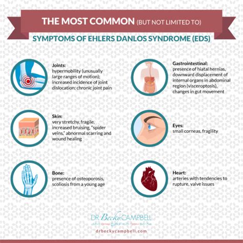 EDS symptoms - Dr. Becky Campbell