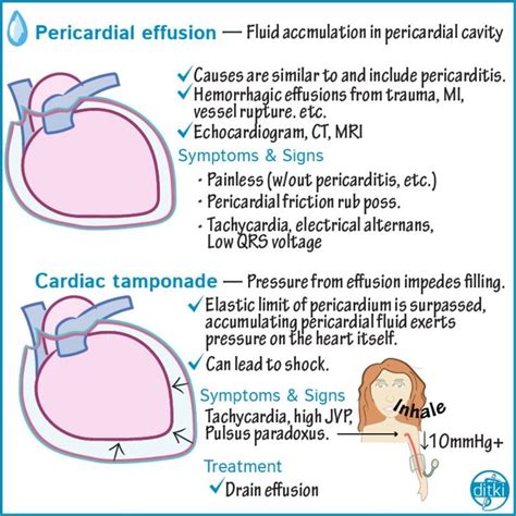 Preview of our upcoming tutorial on Pericardial Diseases! Click the link in our bio to find ...