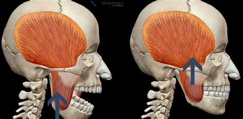 Learn Muscle Anatomy: Muscles of Mastication