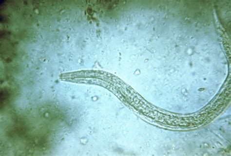 Hookworms in Humans: Signs, Transmission, Prevention