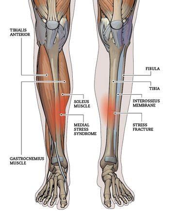 Medial Tibial Stress Syndrome (a.k.a. shin splints) — Attune Massage Therapy Auckland