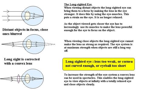 Cyberphysics - The human eye, sight defects and their correction