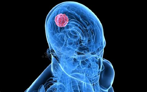 The Enigmatic Function of the Anterior Commissure - Very Big Brain