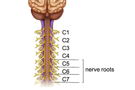 Cervical radiculopathy - Lex Medicus Publishing - Educational resource