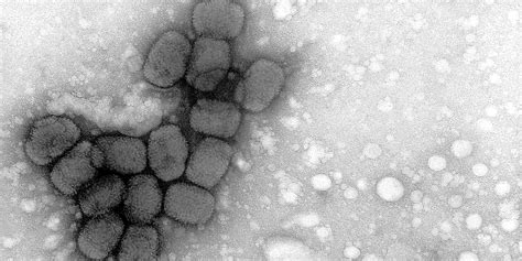 CDC: Smallpox Virus Samples Found In Lab Are Live | HuffPost
