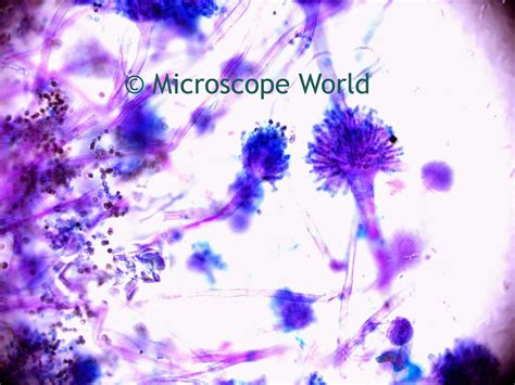 Microscope World Blog: Mold Under the Microscope