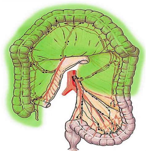 Emergency Treatment of Transverse Colon Cancer | IntechOpen