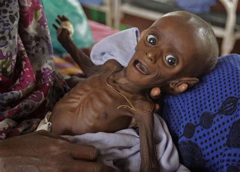 Faces of famine - Photo 1 - Pictures - CBS News