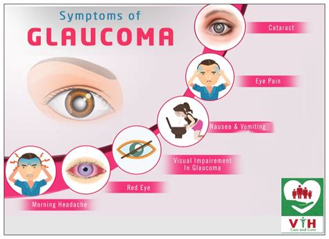 What Are The Symptoms Of Glaucoma | Images and Photos finder