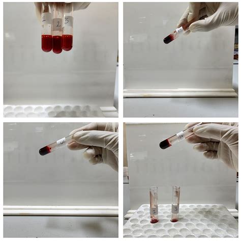 SciELO - Brasil - Comparing modified Lee and White method against 20-minute whole blood clotting ...