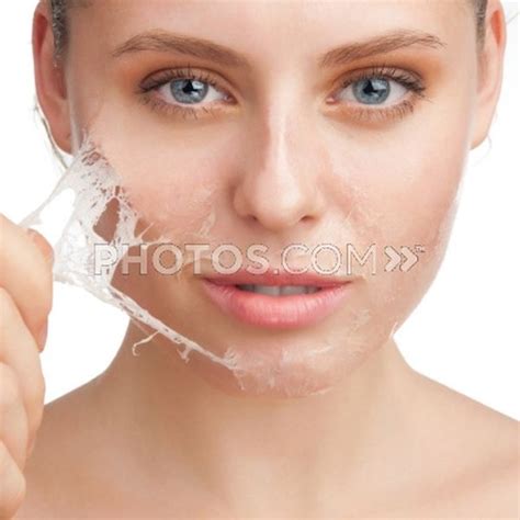 Simple tips to get rid of peeling skin this summer - Beauty Ramp - Beauty & Fashion Guide by Dr ...